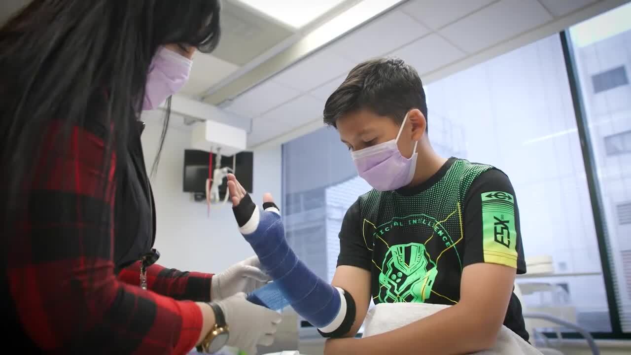 Watch Nathanael get a cast.