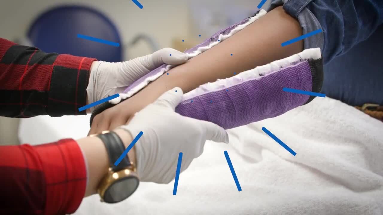 Watch Jordan get a cast removed.