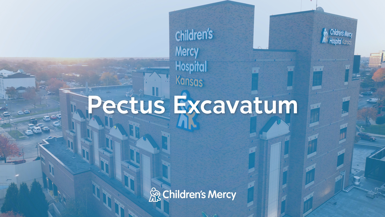 Pectus Excavatum