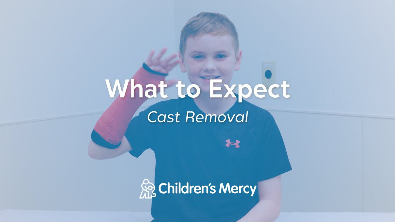 Casting - Getting a Cast Removed