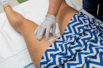 Close up of a catheter tube taped to skin.