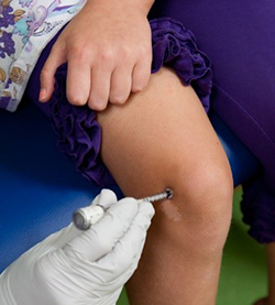 Numbing cream being applied to a patient's knee with a J-tip.