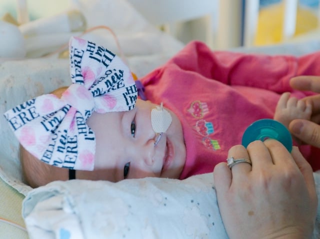 A smiling baby girl with a large bow on her head and a tube leading to her nose lays on her side and smiles. An adult holds her hand and a blue pacifier.