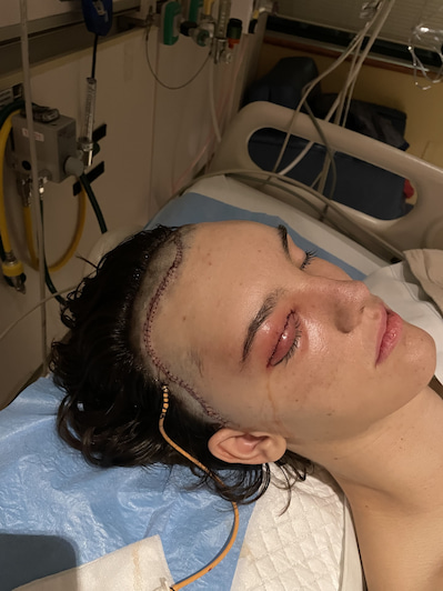 A teenage boy with eyes closed reveals stitches on his left eye and forehead