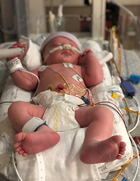 Will McKinnon as a newborn in the NICU laying down with a breathing tube in his nose and other wires attached to him.