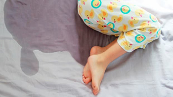 A close shot of a child's legs after he has wet the bed. 