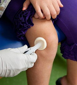 A small soapy sponge being applied to a patient's knee.