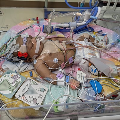 Infant Lilly rests in a hospital bed surrounded by medical equipment and monitoring devices following surgery.